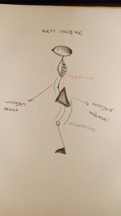 Dlaczego powinniśmy wzmacniać mięsień biodrowo-lędźwiowy? Część 2.